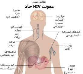 ویروس اچ آی وی