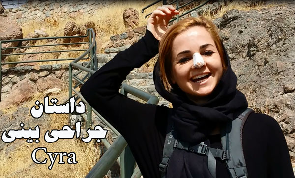 بهترین جراح بینی در ایران - تهران - دکتر حسنانی