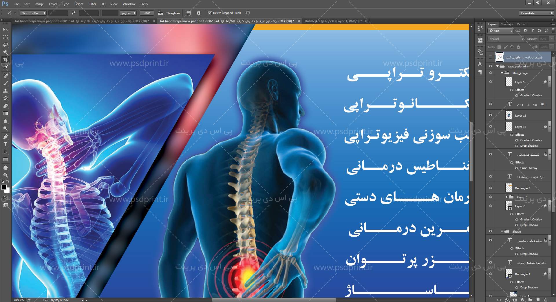 تراکت لایه باز فیزیوتراپی
