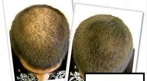  روغن کندش اصل